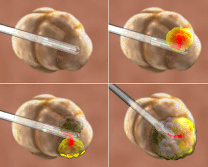 Imagen: El ventilador Triology 100 (Foto cortesía de Royal Philips Electronics).